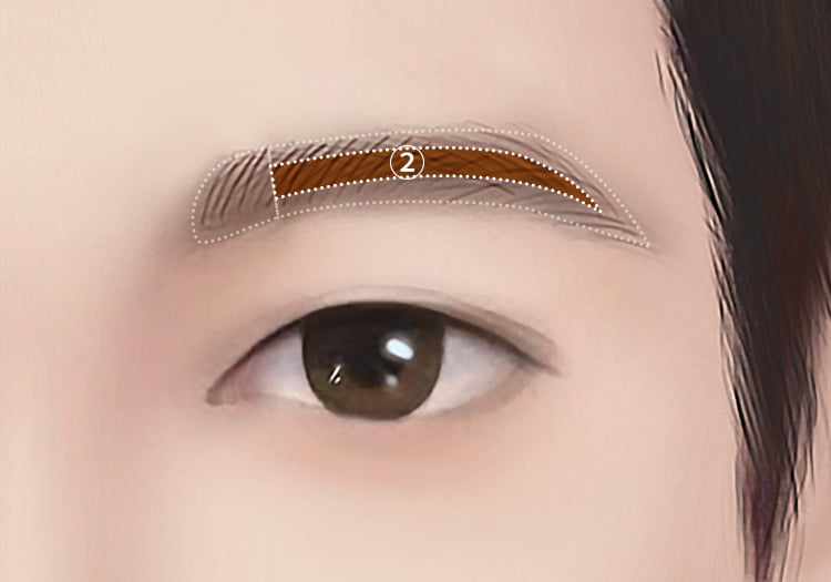 눈썹이식으로 눈썹 중앙부에 중간 모를 이식한 남자의 그림 