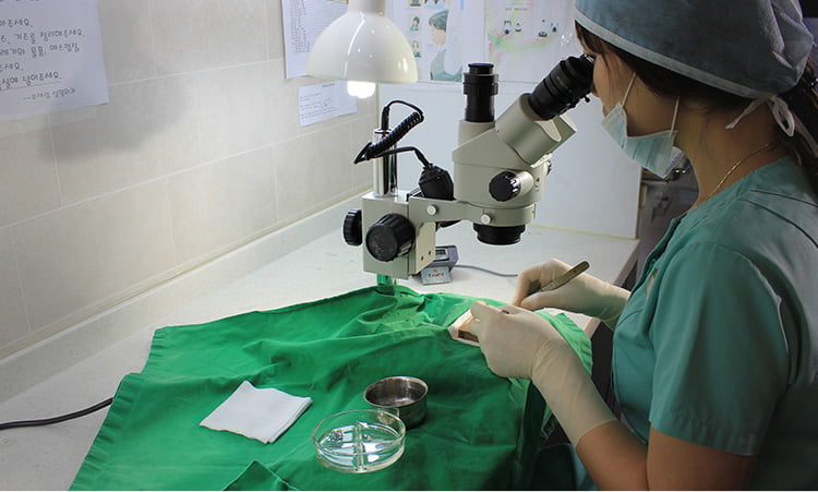 고배율 현미경으로 모낭을 분리 중