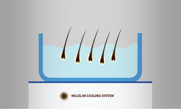 적절한 온도에 보관 중인 모낭들