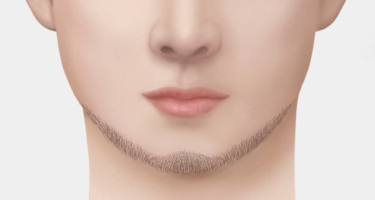 친커튼 스타일로 수염이식한 주걱턱이거나 턱이 뾰족한 남자의 사진