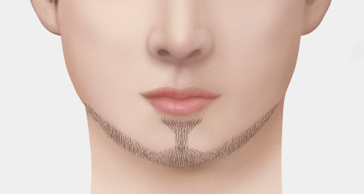 노리스 스키퍼 스타일로 수염이식한 둥근 얼굴이거나 주걱턱인 남자의 사진