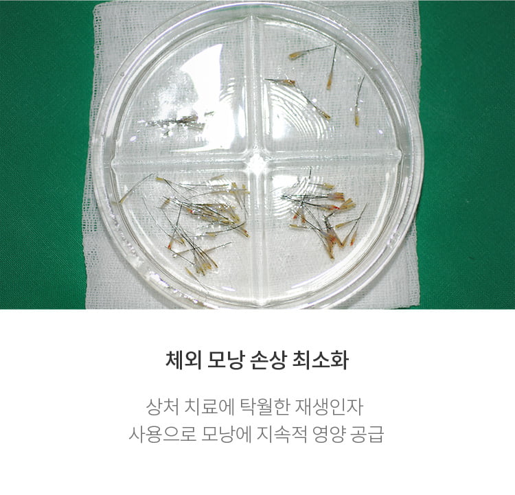 재생인자에 담구어진 모낭들