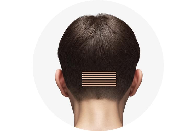 1~2mm 간격으로 한 줄씩 테이핑 후 모발을 채취하는 하이드컷을 설명하는 그림