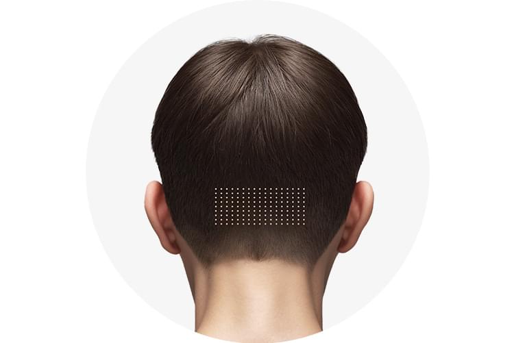 삭발 또는 면도없이 가장 티나지 않는 컷팅 방식으로 모발을 채취하는 노컷을 설명하는 그림