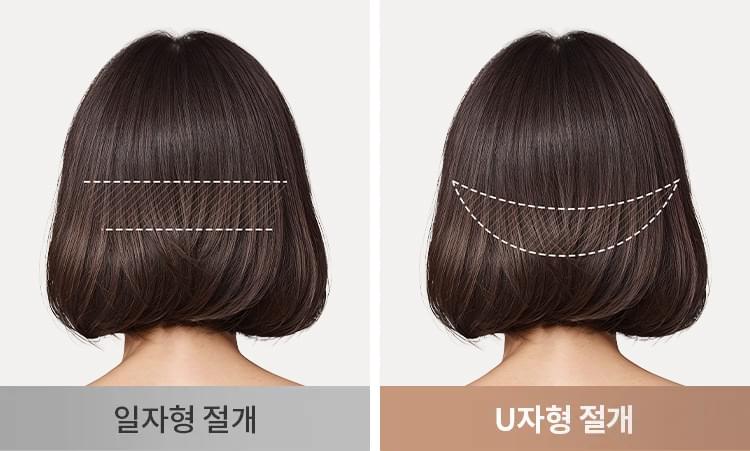 뒤통수 절개하는 방식 설명