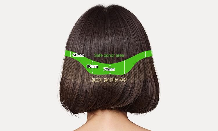 적합한 뒤통수 절개 영역 확인