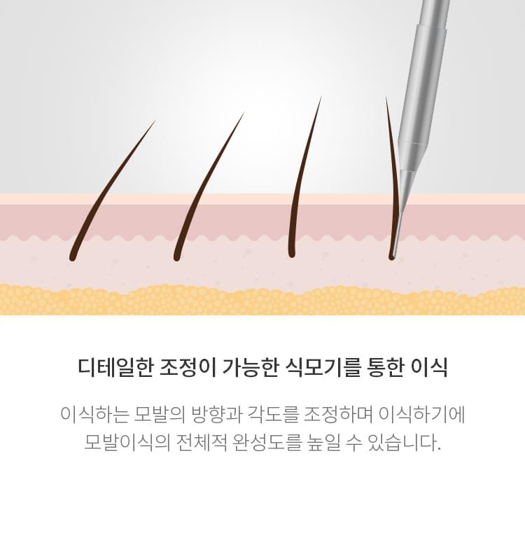 전체적으로 완성도를 높이기 위해 이식하는 모발의 방향과 각도를 조정하는 식모기의 그림